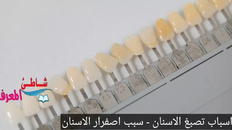 اسباب تصبغ الاسنان - سبب اصفرار الاسنان