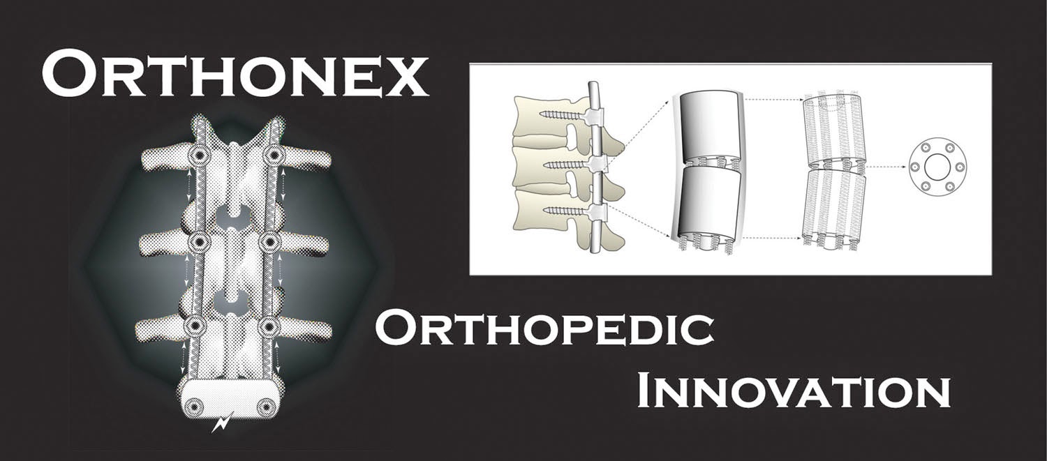 China Orthopedic Devices Industry