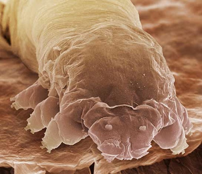 eye lash mite Demodex Folliculorum