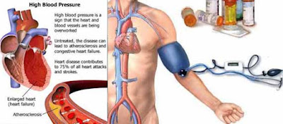 Cara Mengobati Darah Tinggi Paling Mujarab
