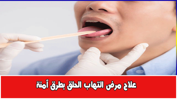 علاج التهاب الحلق