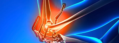 https://www.performancepain.com/conditions/sciatica/