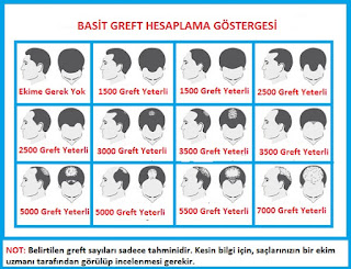 greft hesaplama programı