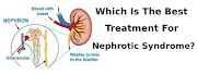 Which Is The Best Treatment For Nephrotic Syndrome?