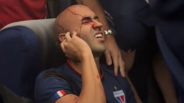 Jogadores do Fortaleza ficam feridos após ônibus ser atacado por torcedores do Sport; assista