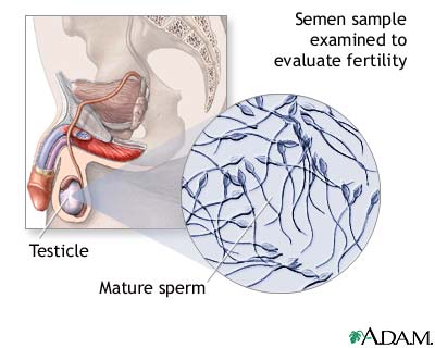 Merokok jejas kualiti sperma ~ seribupilihan