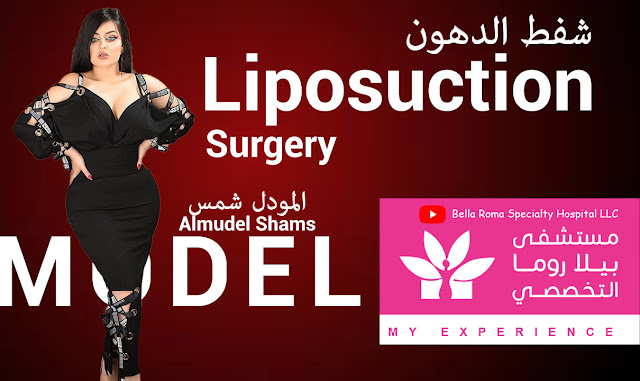 Liposuction Surgery in Bella Roma Hospital | شفط الدهون بيلا روما