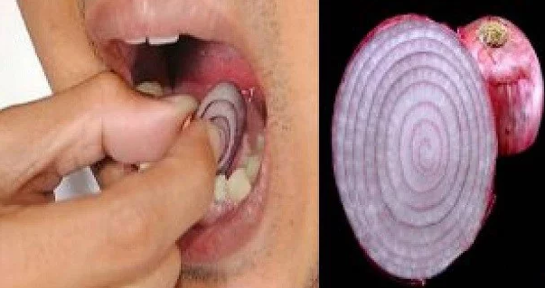 Place A Slice Of Onion On Your Tooth For 15 Minutes. Look What Happens!