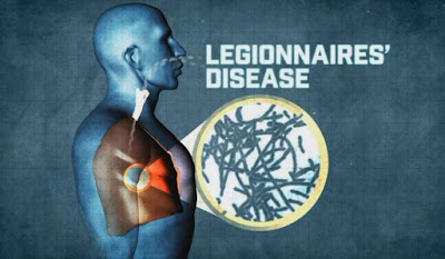 Legionnaires Disease Pictures