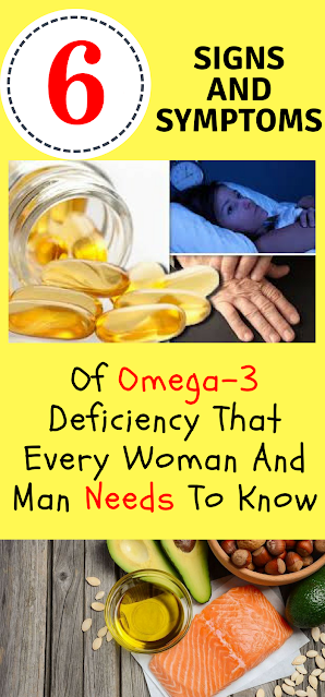 6 Signs You Have An Omega-3 Deficiency