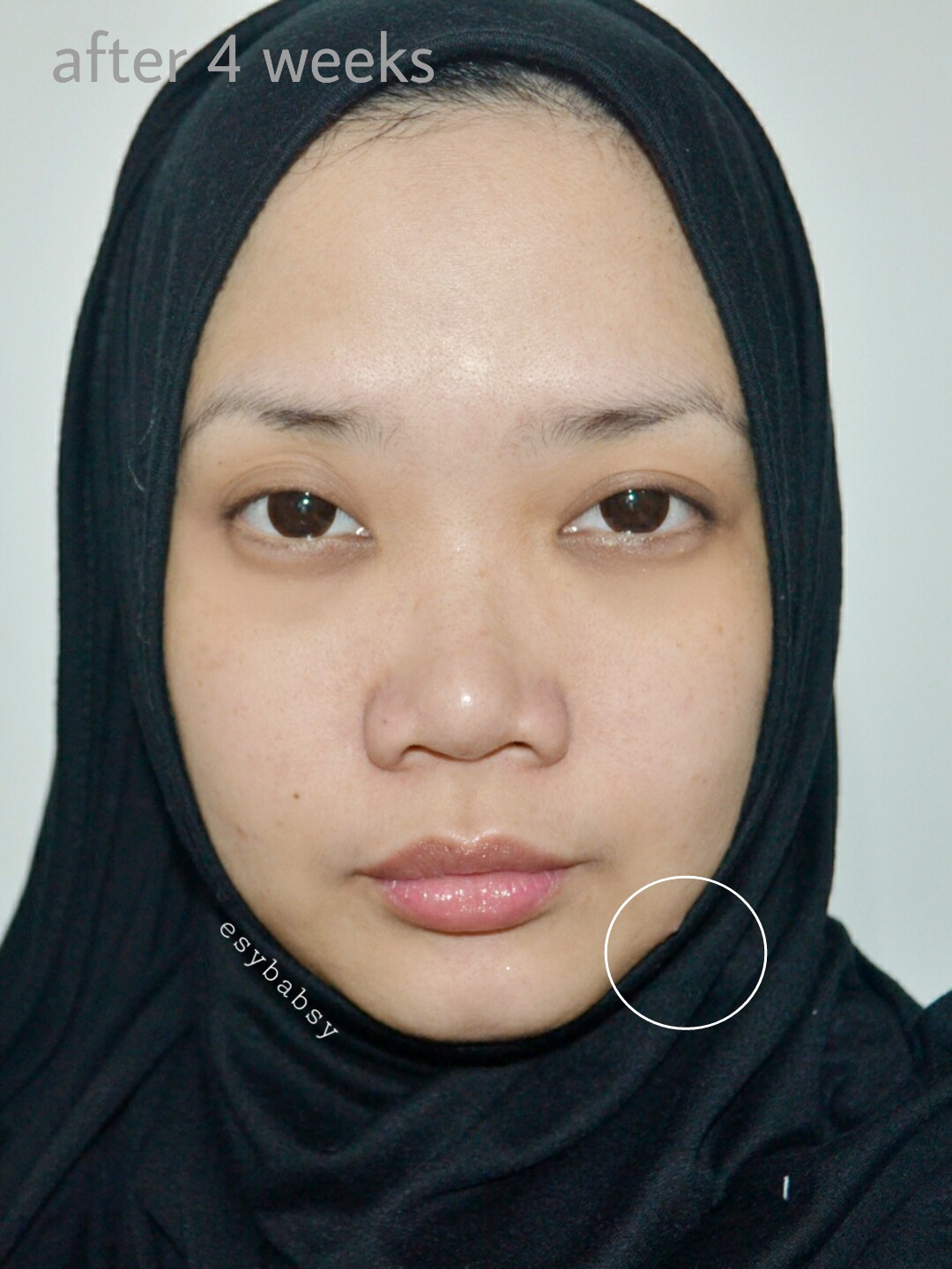 review-avoskin-miraculuous-refining-serum-esybabsy