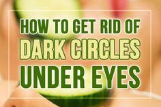 How to Get Rid of Dark Circles Under Eyes