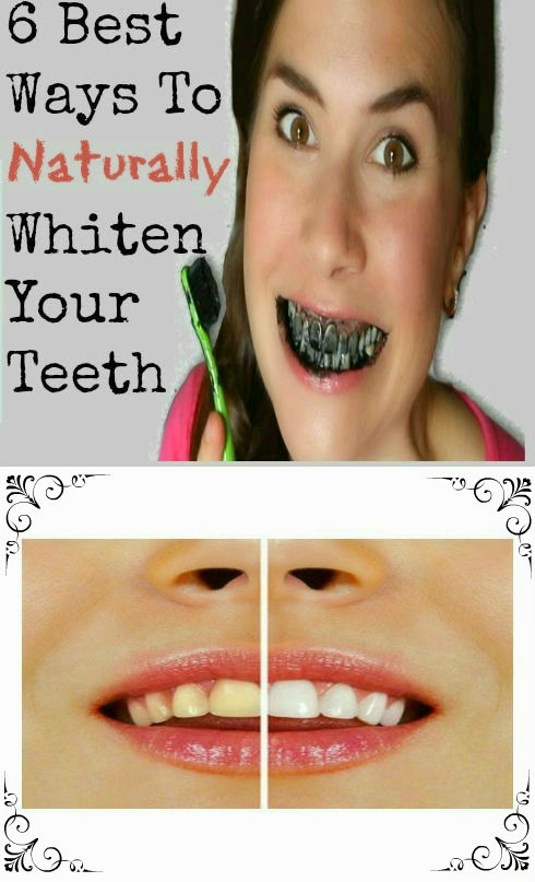 6 Best Ways To Naturally Whiten Your Teeth | Natural Tooth ...