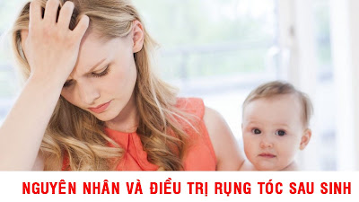 Cách điều trị rụng tóc sau sinh kích thích mọc tóc nhanh dài