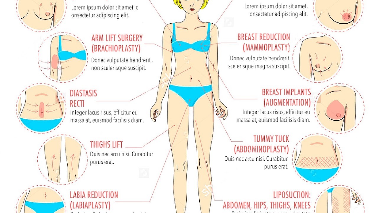 Breast Lift Vs Implants