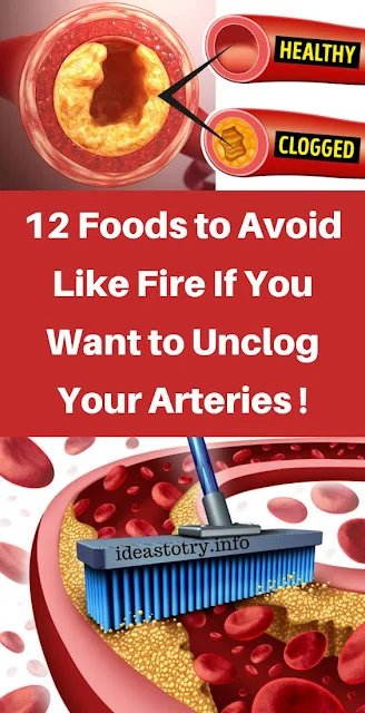 12 Foods to Avoid Like Fire If You Want to Unclog Your Arteries 