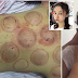 Chinese actor dies after choosing traditional chinese medicine over chemotherapy