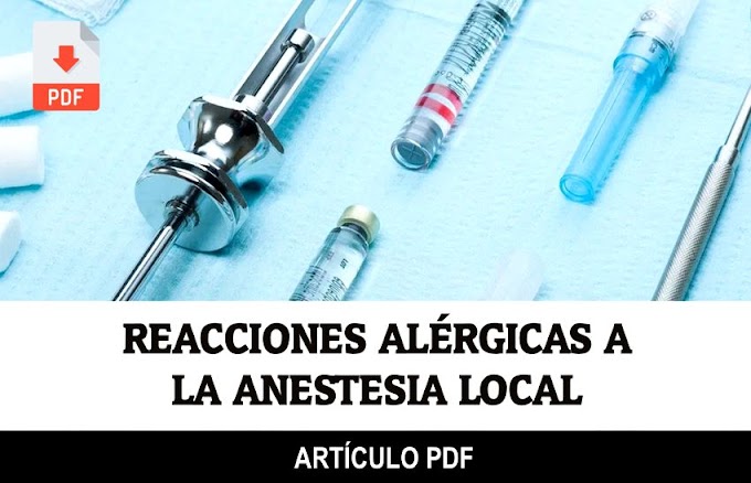 PDF: ANESTESIA DENTAL - Reacciones alérgicas a la Anestesia Local. Signos y Síntomas