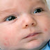 Red spots appear on the face of the baby? Do Not Trigger Panic!