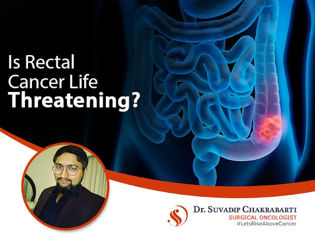 rectal cancer doctor in kolkata