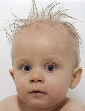 Tips Cara Mengatasi Rambut  Rontok  Pada Anak 