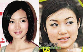 Tracy Ip Chui Chui Plastic Surgery