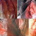 obat gonorrhea sakit saat kencing keluar nanah