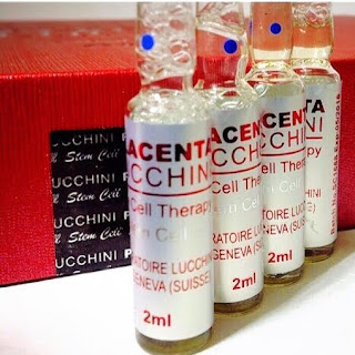 PLACENTA LUCCHINI - LIFE CELL THERAPY STEM CELL