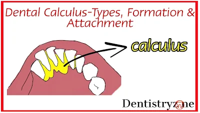 Dental calculus- Types, Formation & Attachment | Periodontology | Dentistry.