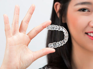 Chuyên gia nói gì về ưu điểm của niềng răng invisalign 