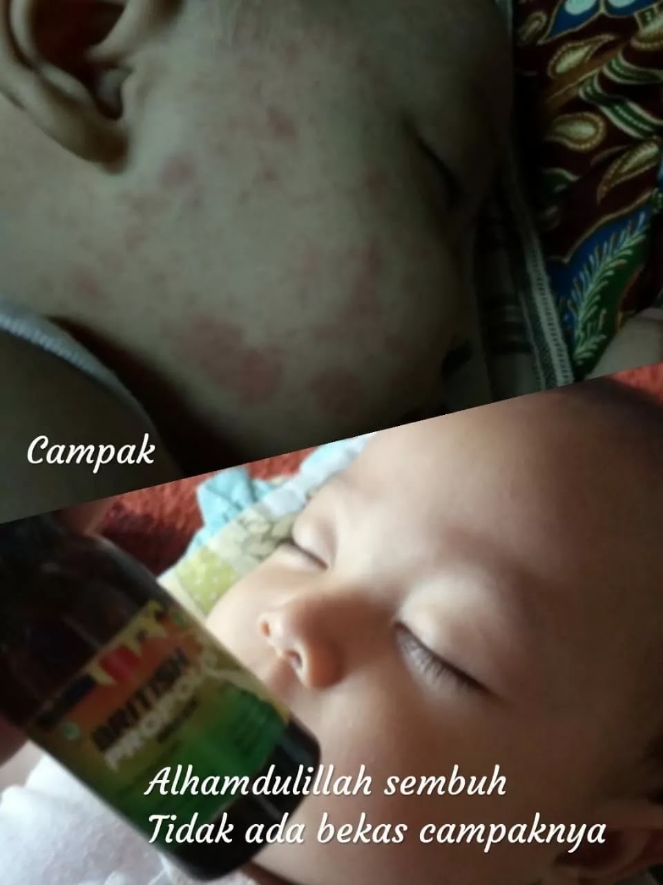 khasiat british propolis untuk anak