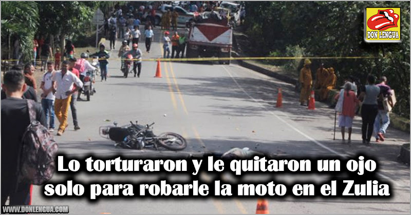 Lo torturaron y le quitaron un ojo solo para robarle la moto en el Zulia