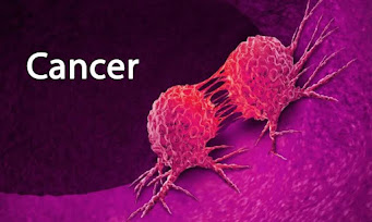 CANCER : overview, Types, Causes, Treatment, Diagnosis
