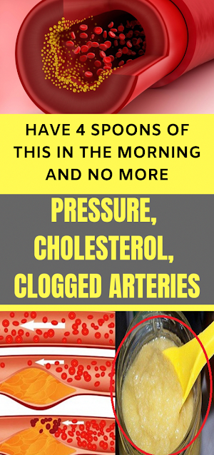 Have 4 Spoons of This In the Morning and No More Pressure, Cholesterol, Clogged Arteries