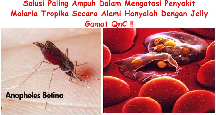 Obat Tradisional Malaria Tropika