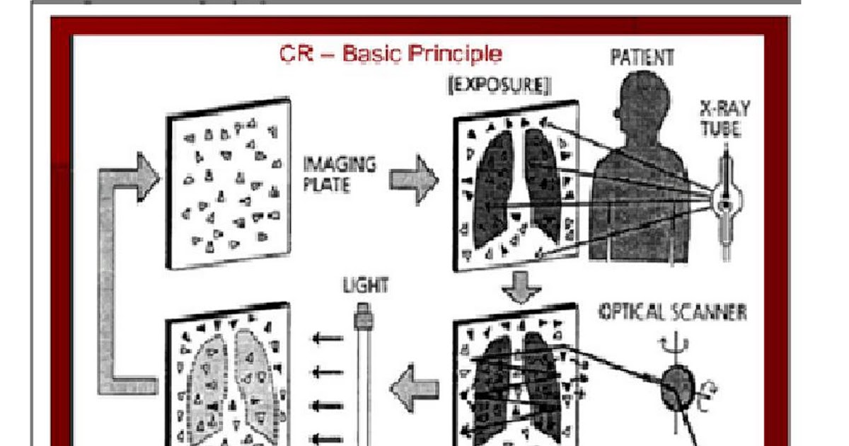 block note Computed Radiography CR block note Computed Radiography CR