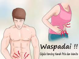 OBAT KENCING NANAH MANJUR