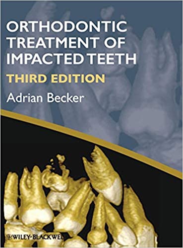 Orthodontic Treatment of Impacted Teeth