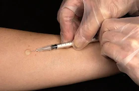 Tuberculosis Vaccine