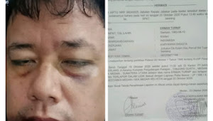 Karena Dianiaya, Erman Turnip Laporkan PT. Sahabat Jaya Cemerlang Ke Polsek Medan Helvetia