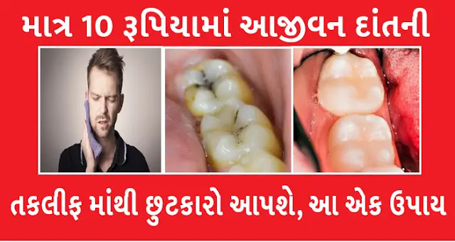 Best home Remedy for teeth