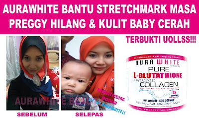 nak kulit cantik bersih berseri aurawhite dee wellness 