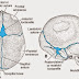 What Causes Soft Spots On Adults Head