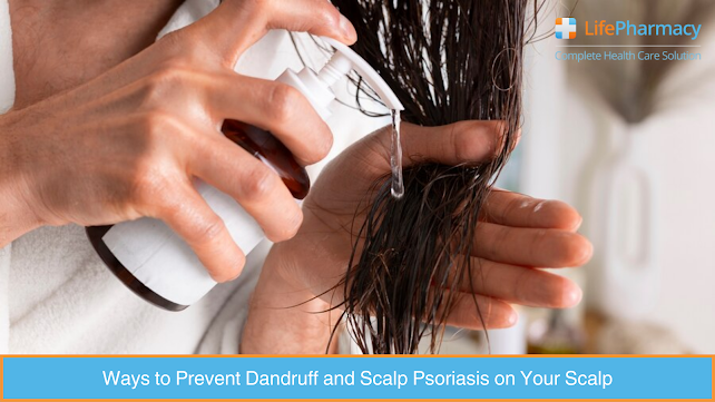 Ways to Prevent Dandruff and Scalp Psoriasis on Your Scalp