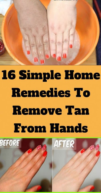16 Simple Home Remedies To Remove Tan From Hands