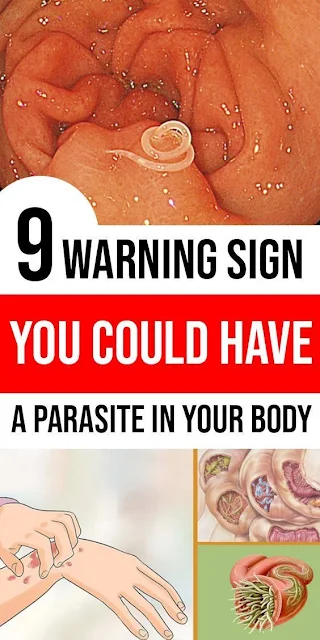 9 Signs You Could Have a Parasite