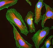 What are HeLa Cells? : The Immortal Cell Line. 