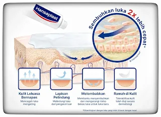 Manfaat Hansaplast Salep Luka Untuk Berbagai Masalah Kulit dan Luka