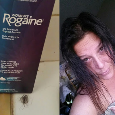 Rogaine #chatterbox 