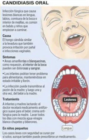 Os Y Todo Lo Que Ello Conlleva Mamas A Tiempo Completo Blog De Maternidad Nin